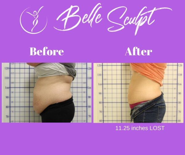 Belle Sculpt Fat Burning & Body Sculpting only at Healthworks