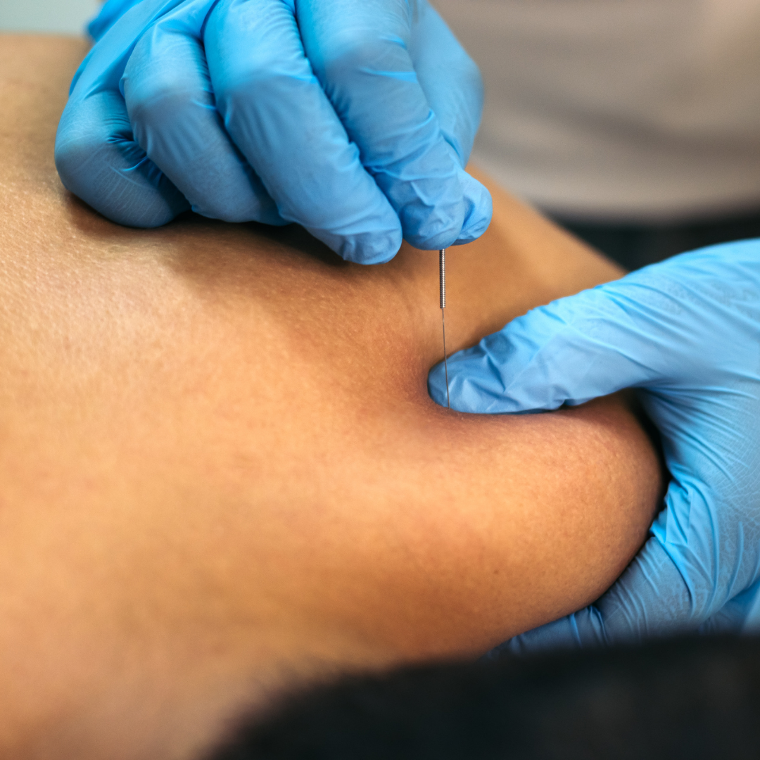 Untitled design (30)