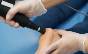 Energy Waves for Healing: Innovative Ways Shockwave Therapy Accelerates Recovery